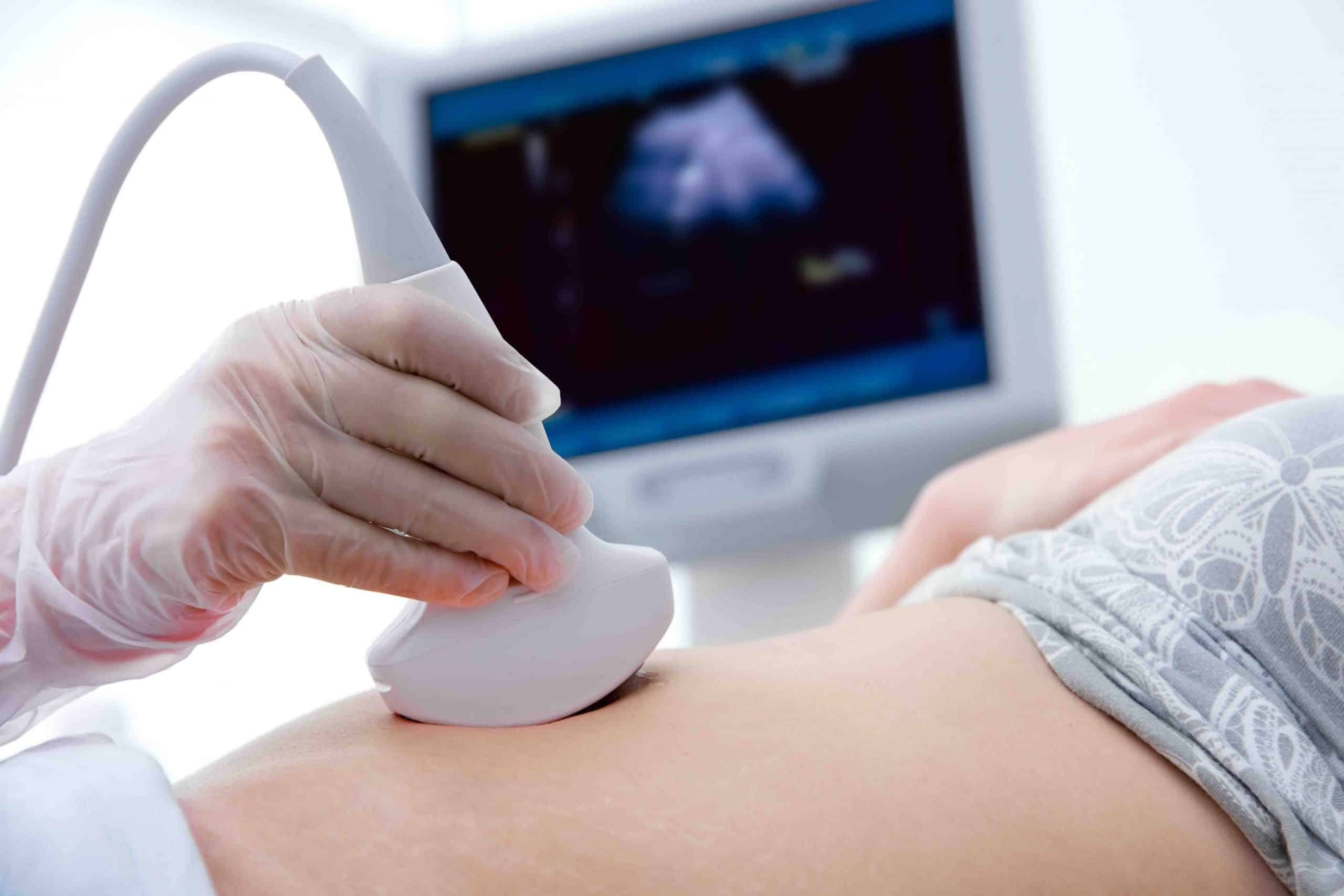 pregnancy ultrasound Singapore - W Gynae